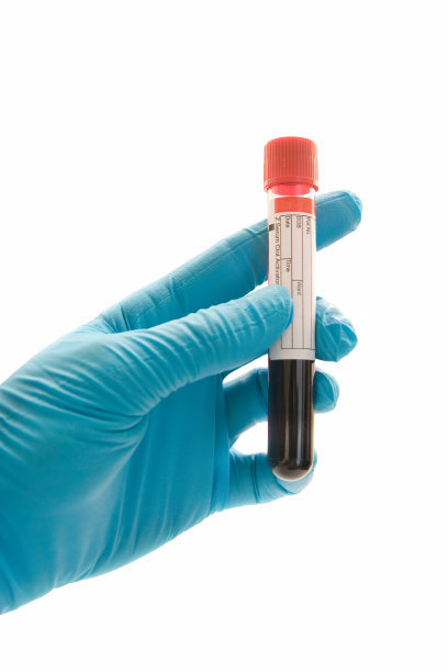 验血：香港验血技能可靠吗男女验血需要多少周。